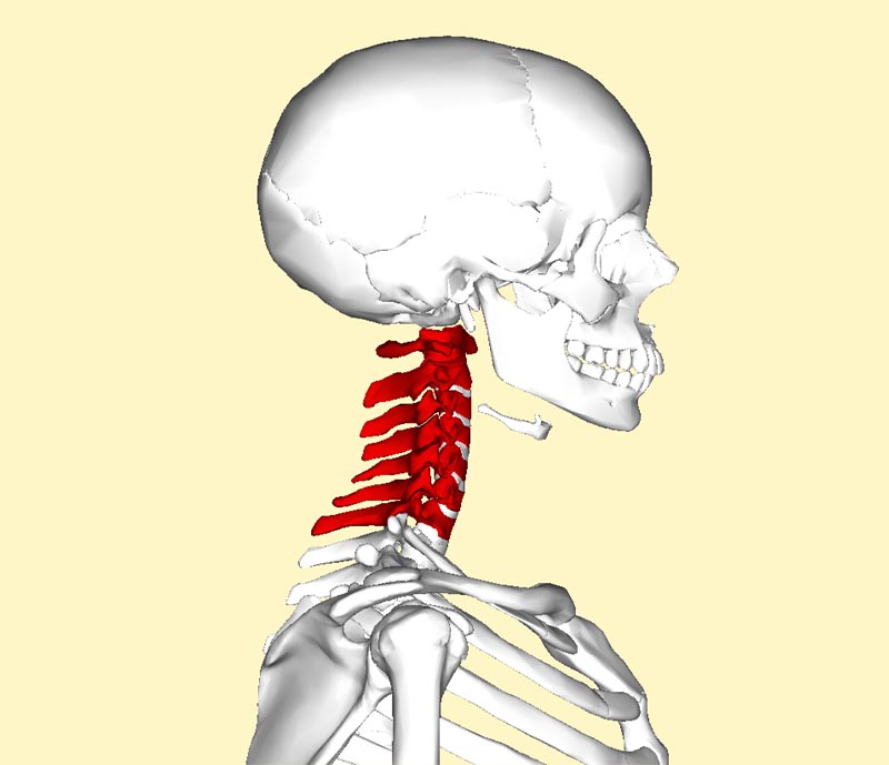 Cervical Spondylosis Treatment by Dr Tarun Kumar Adukia at Neuro Clinic Ranchi