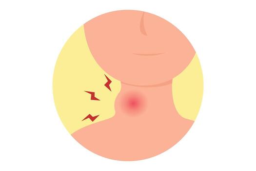 Thyroid-related mental health support in Ranchi